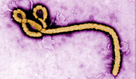 What the U.S. needs to do about Ebola